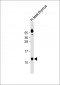 AHSP Antibody (Center)